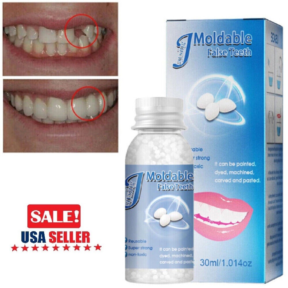 Resin Teeth Repair Kit - Moldable Temporary Dental Gap Filler, 2 Pieces