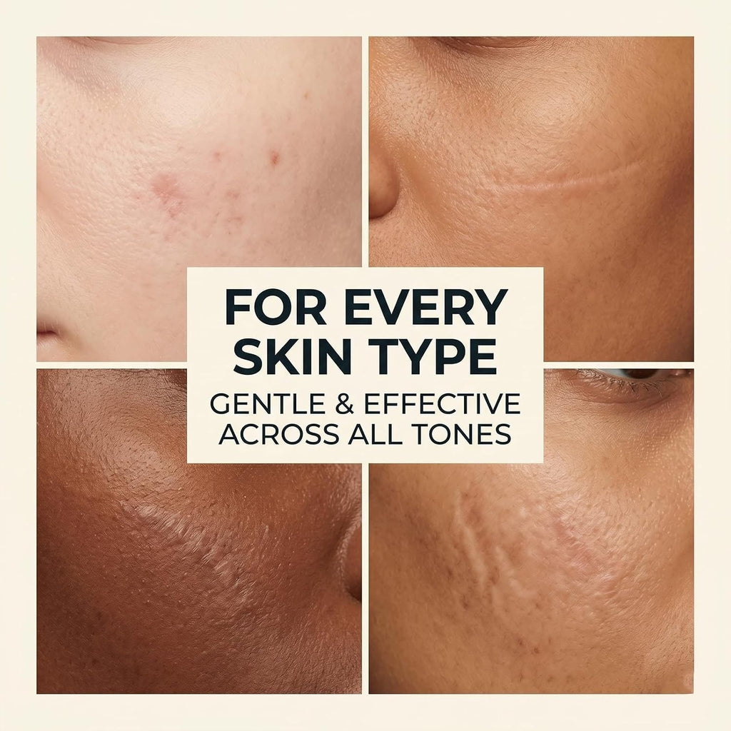 Silicone Scar Stick for Old & New Scars - Acne & Stretch Mark Treatment