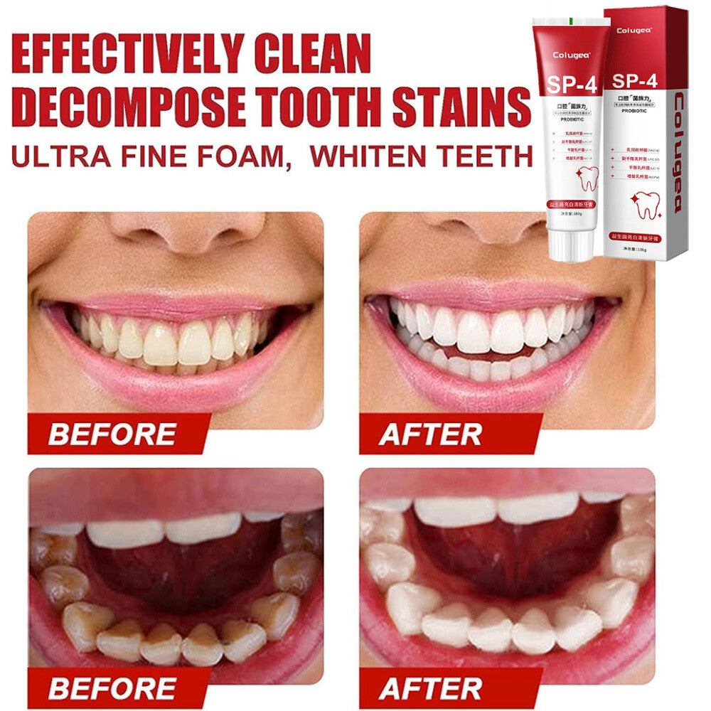 Probiotic Whitening Toothpaste for Bright, Healthy Smile - Removes Stains