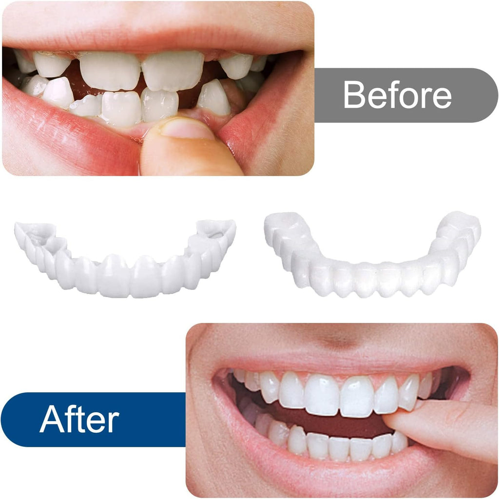 2 Pairs Veneers Snap in Teeth - Comfort Fit Whitening Denture