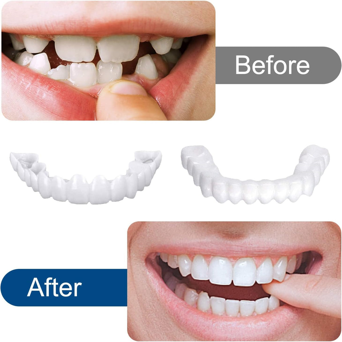 2 Pairs Veneers Snap in Teeth - Comfort Fit Whitening Denture