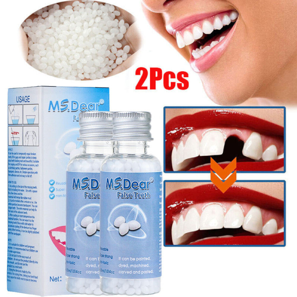 Teeth Repair Kit - Temporary Dental Filling & Missing Tooth Replacement
