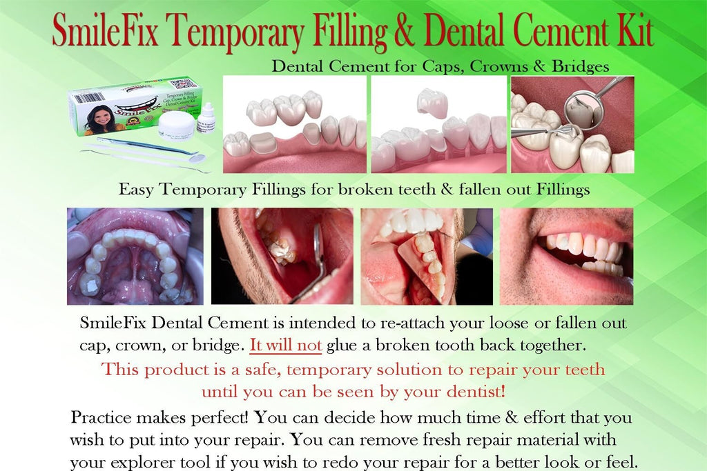 Emergency Dental Repair Kit with Dental Cement for Crowns & Bridges