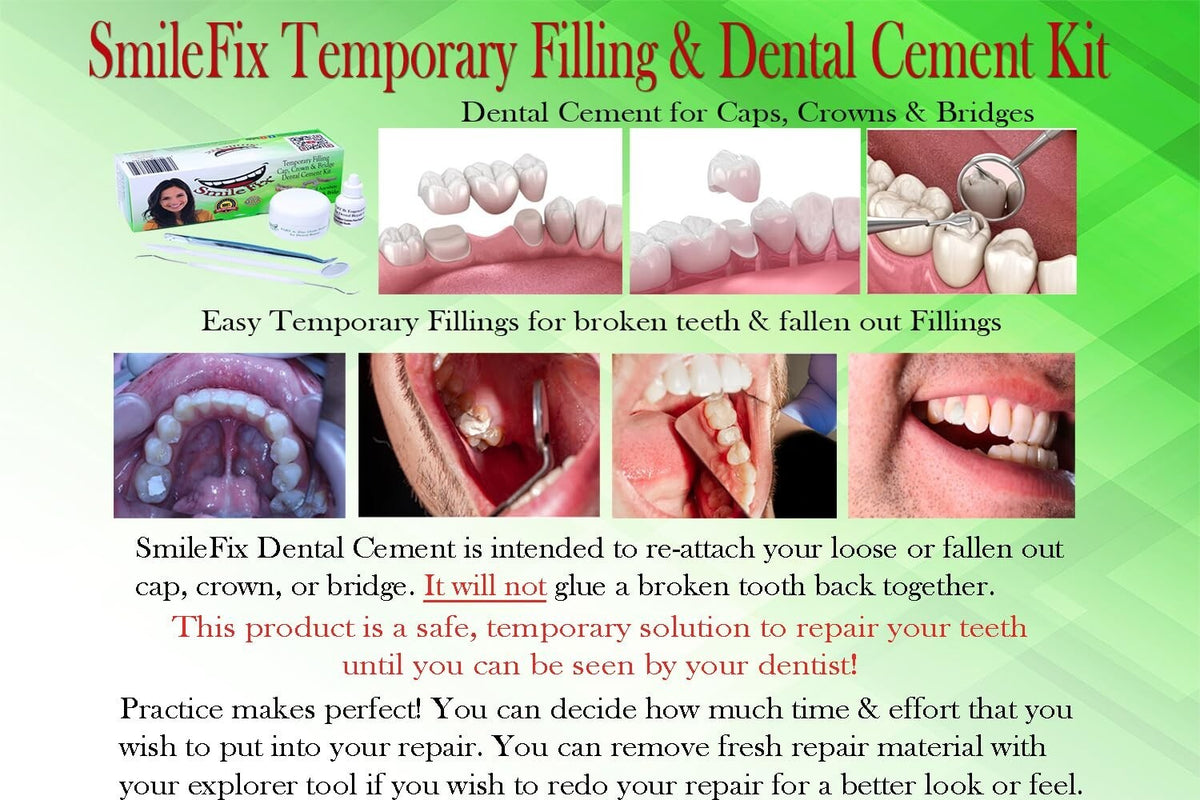 Emergency Dental Repair Kit with Dental Cement for Crowns & Bridges