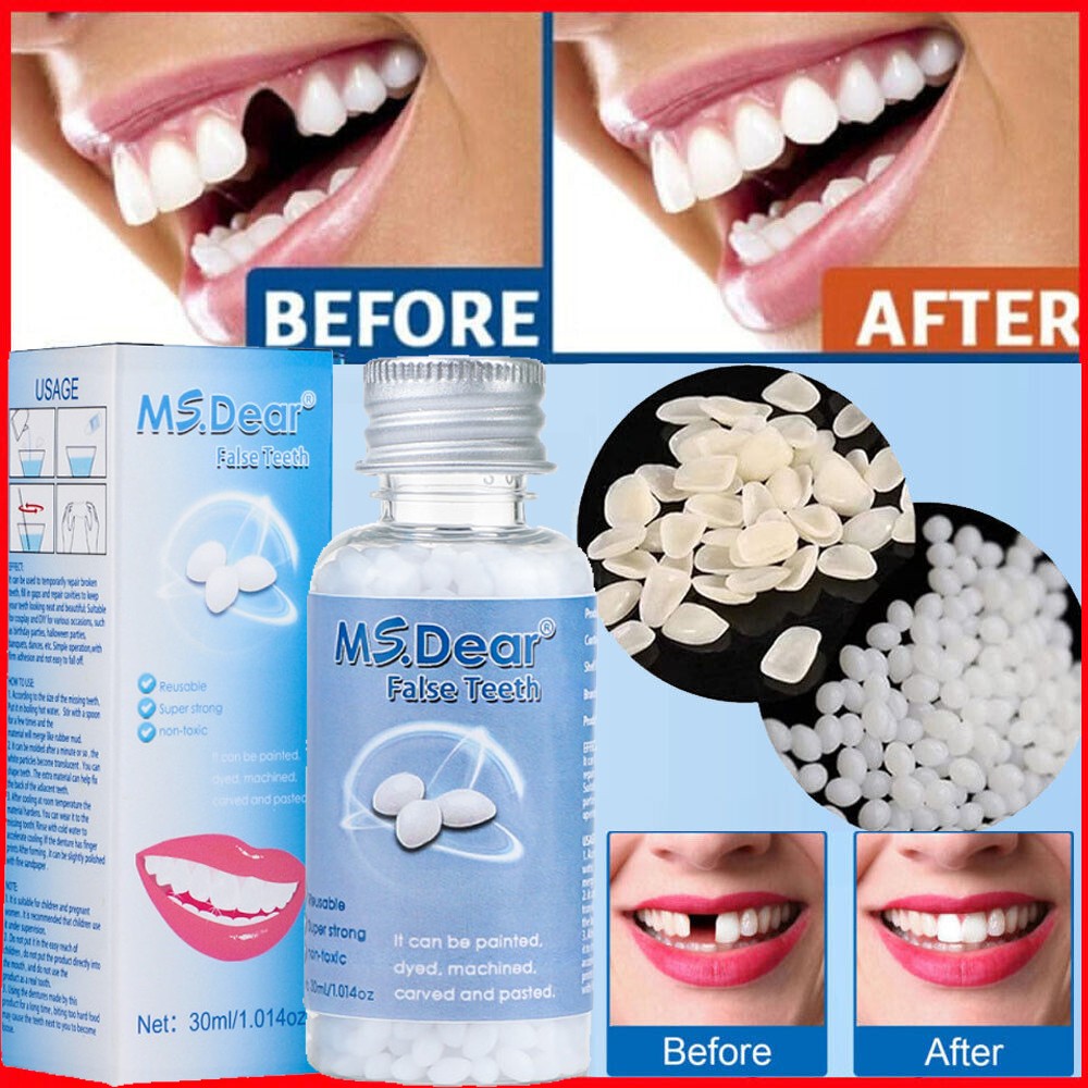 Teeth Repair Glue - Moldable Temporary Dental Cement for Broken Gaps 30ml