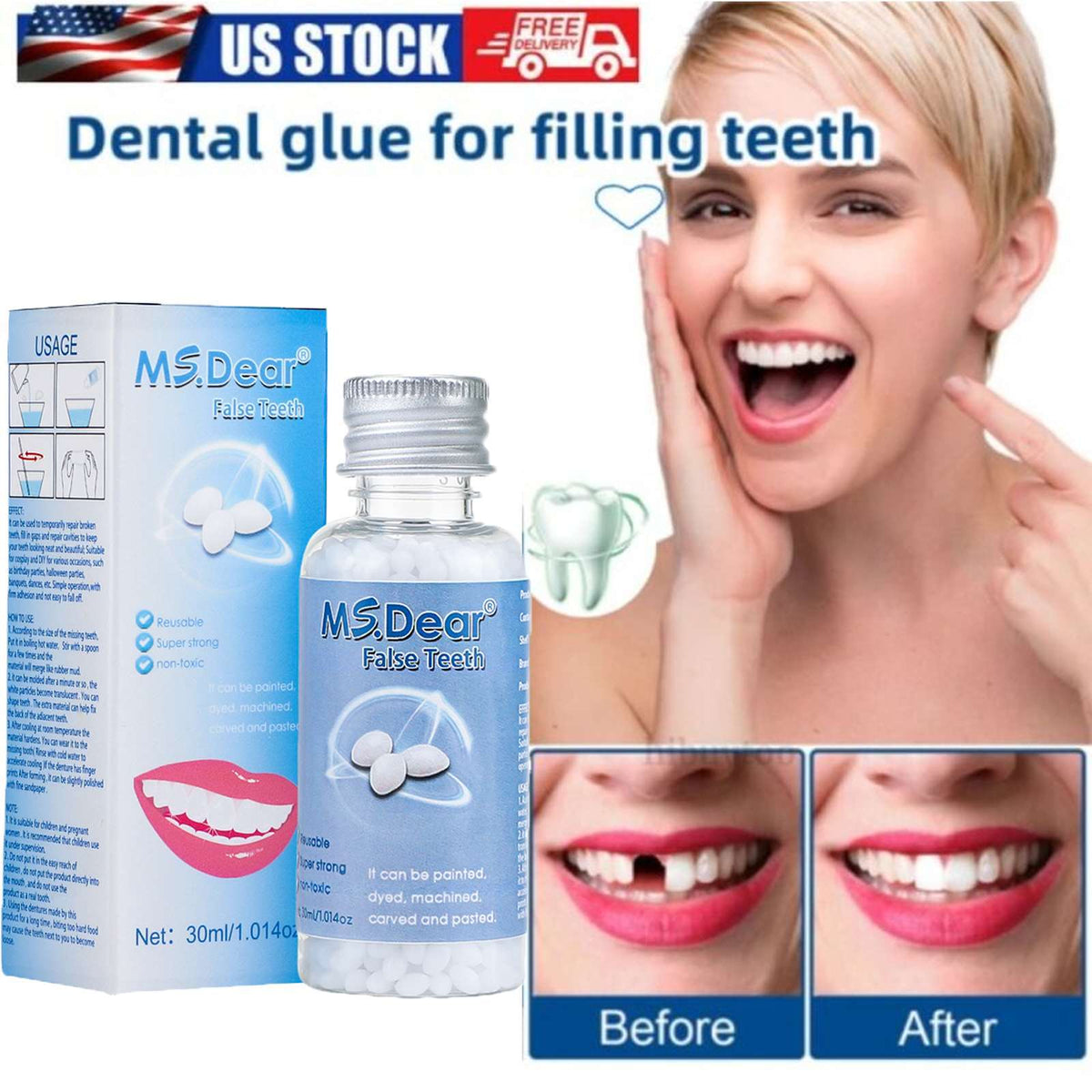 Reusable Moldable Tooth Repair Kit with Beads for Temporary Dental Fixes
