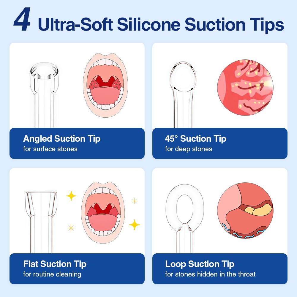 Electric Tonsil Stone Remover Kit with LED Light & Adjustable Suction Modes