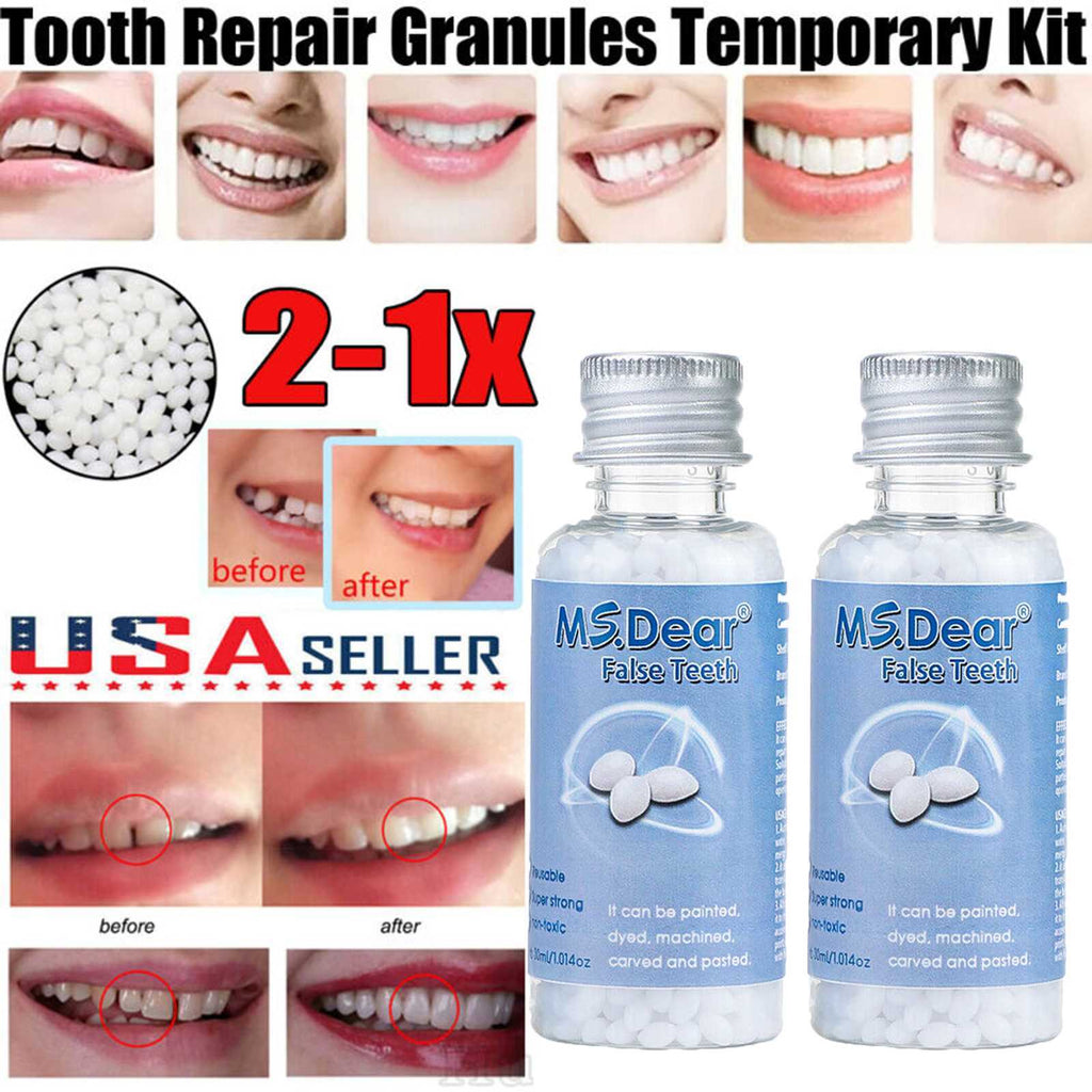 Temporary Tooth Repair Beads Moldable Dental Filler for Broken Gaps & Cavities