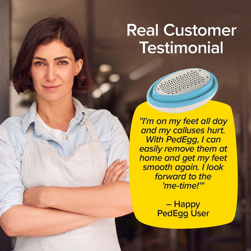 PedEgg Classic Callus Remover for Feet - Exfoliates Dry Skin & Calluses