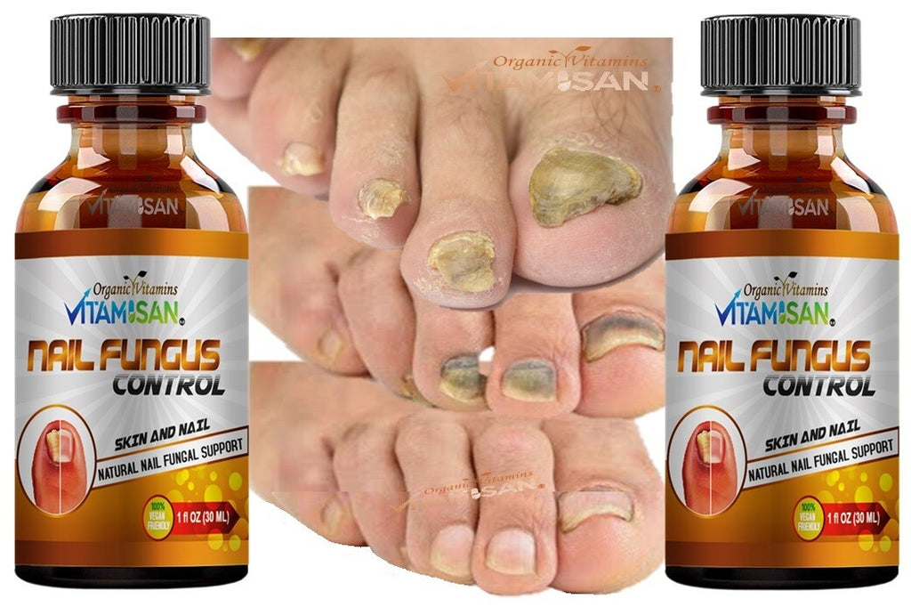 Maximum Strength Antifungal Toenail & Foot Support Spray for Athlete's Foot