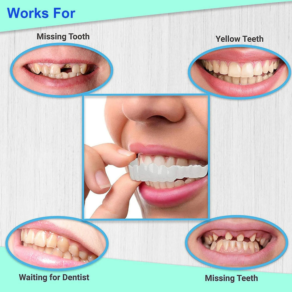 Upper and Lower Snap-On Dental Veneers & Teeth Cover Set for Adults