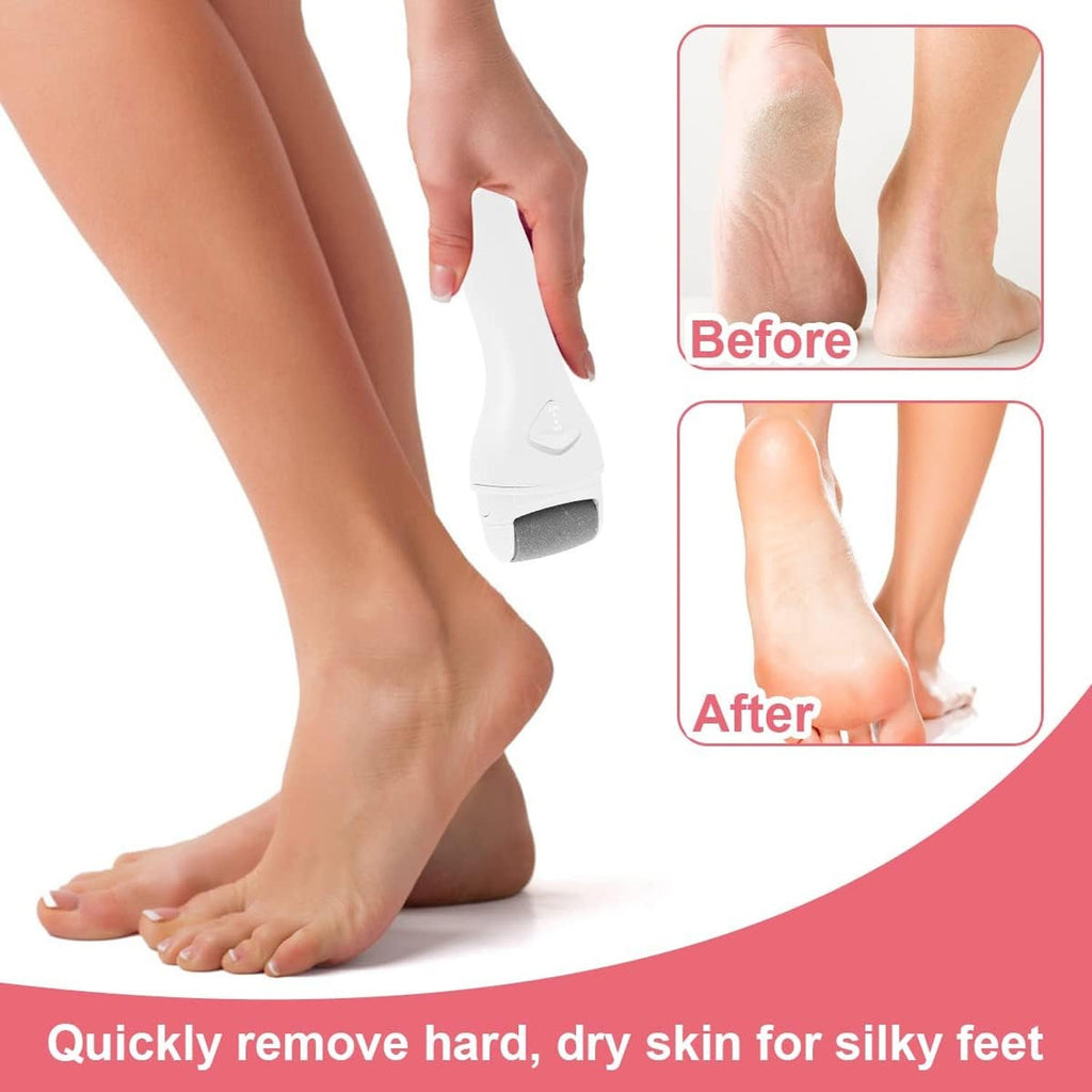 Electric Foot Grinder Pedicure File Machine Callus Remover USB Rechargeable