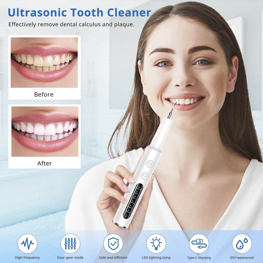Ultrasonic Tooth Cleaner Tartar Removal Kit - Electric Dental Whiten & Plaque Remover