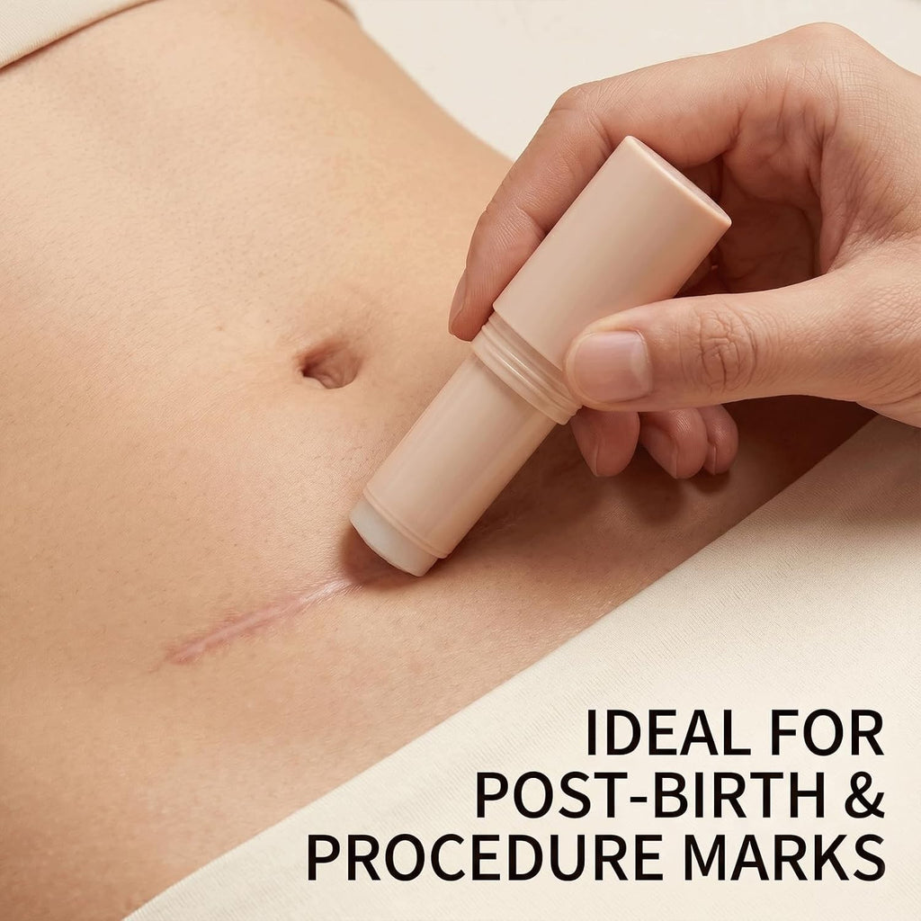 Silicone Scar Stick for Old & New Scars - Acne & Stretch Mark Treatment