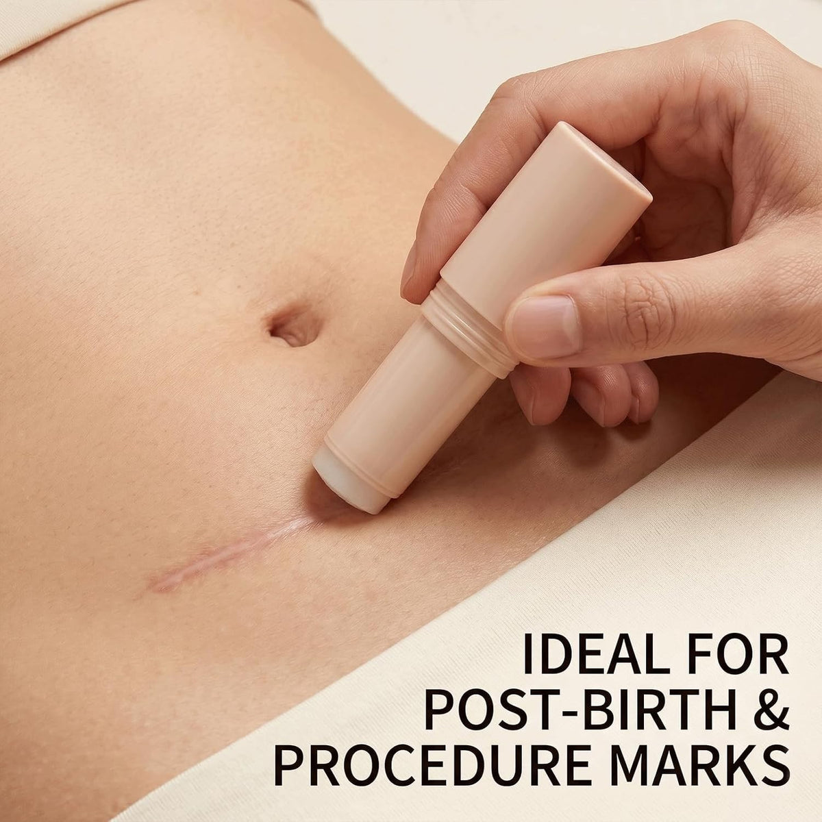 Silicone Scar Stick for Old & New Scars - Acne & Stretch Mark Treatment