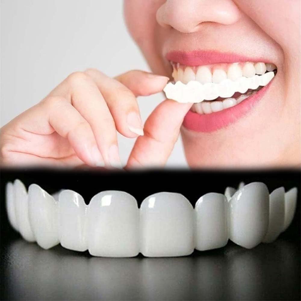 Temporary Dental Veneers Kit - Instant Smile Makeover for Men & Women