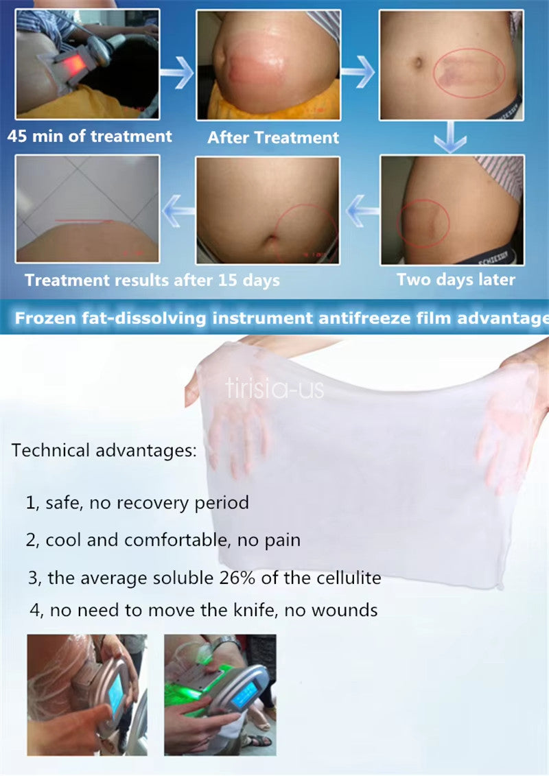 Condensing Pad for Beauty Machine Skin Protection Anti-Freezing Film - Multiple Sizes & Quantities