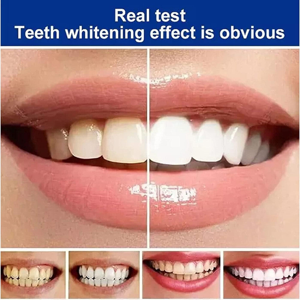 Probiotic Whitening Toothpaste for Bright, Healthy Smile - Removes Stains
