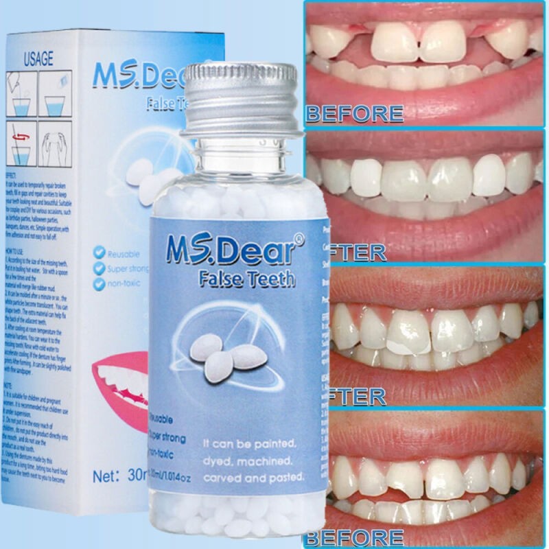 Moldable Teeth Repair Glue for Gaps & Broken Teeth - 30ml