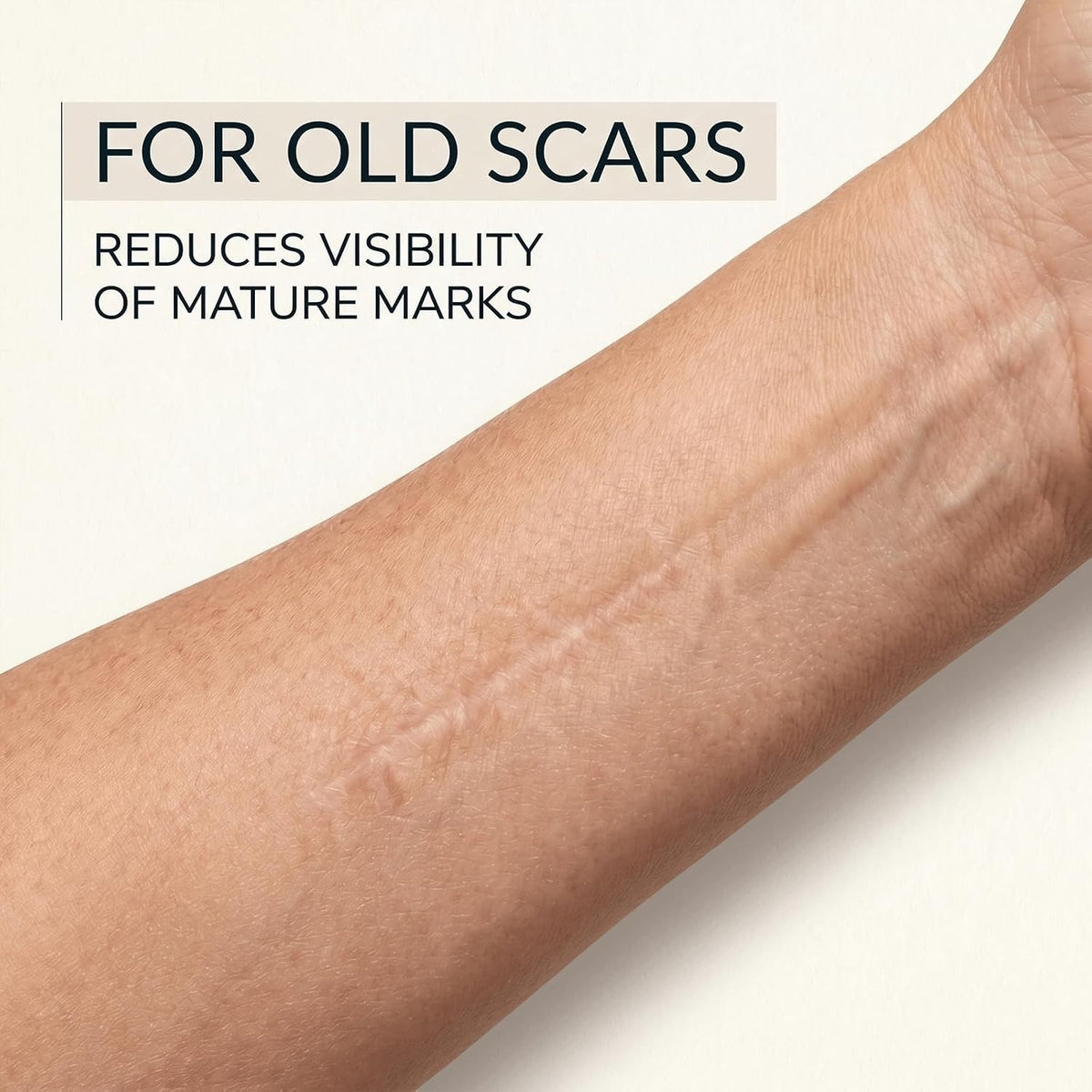 Silicone Scar Stick for Old & New Scars - Acne & Stretch Mark Treatment