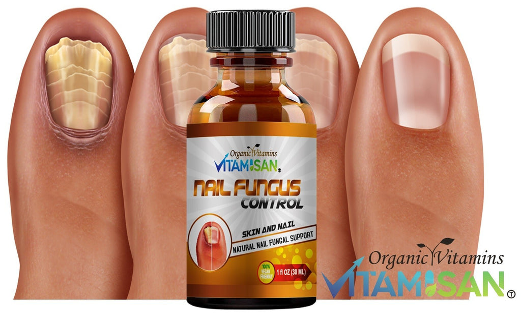 Maximum Strength Antifungal Toenail & Foot Support Spray for Athlete's Foot