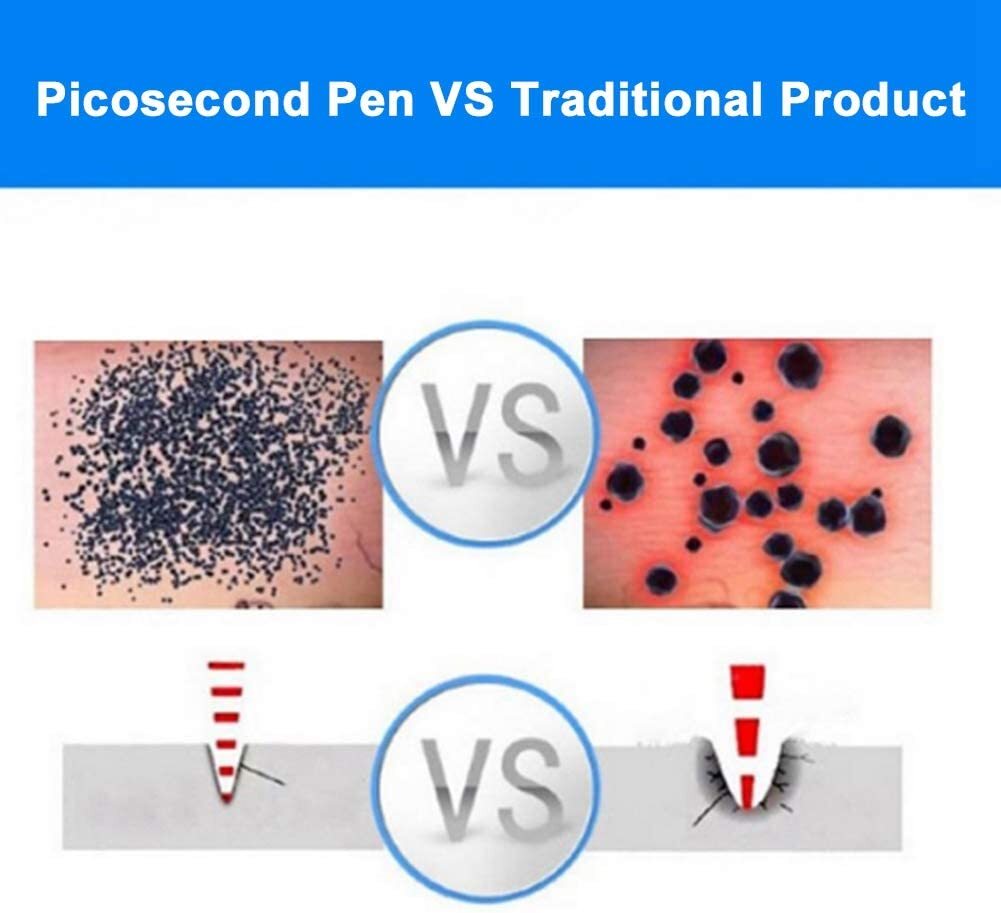 Rechargeable Laser PicoSecond Plasma Pen for Freckle Removal with Red Light Therapy