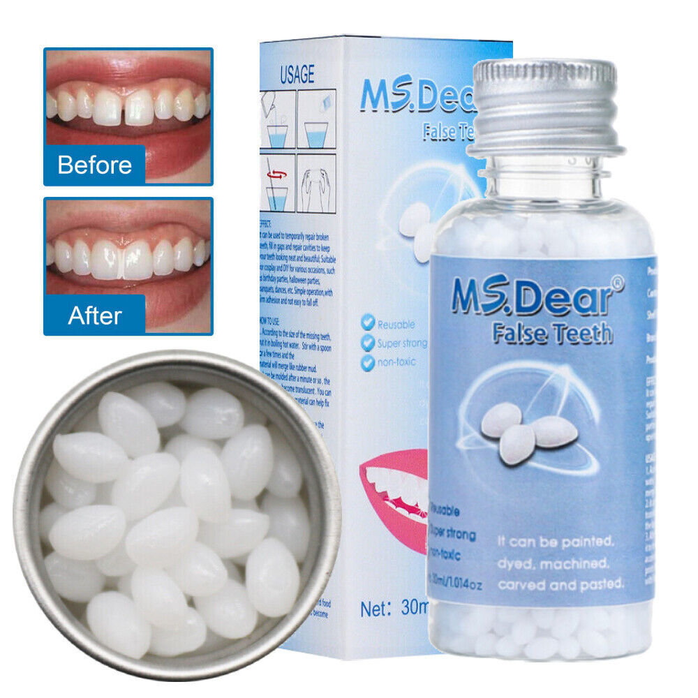 Teeth Repair Beads for Loose Tooth Fixing - Temporary Dental Moldable Resin