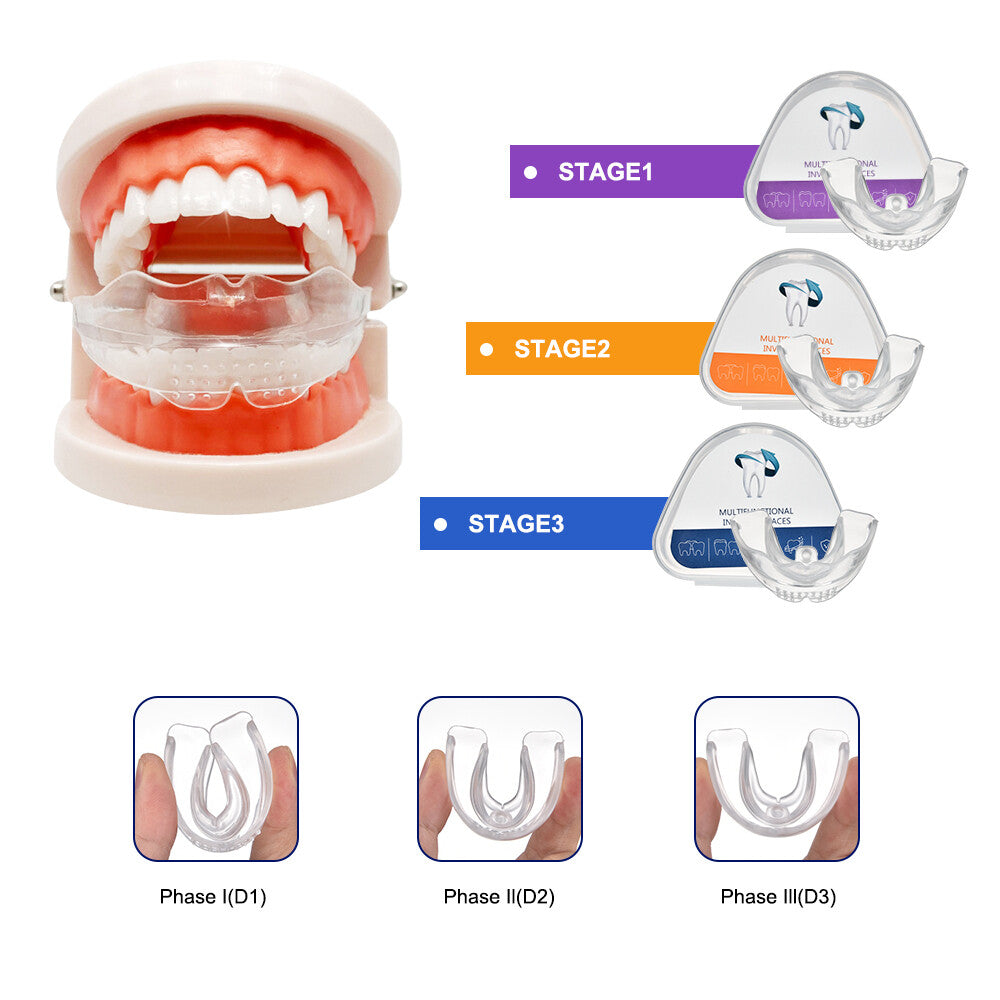 Adult Teeth Aligners Orthodontic Braces Trainer for Dental Alignment - 3-Stage Set