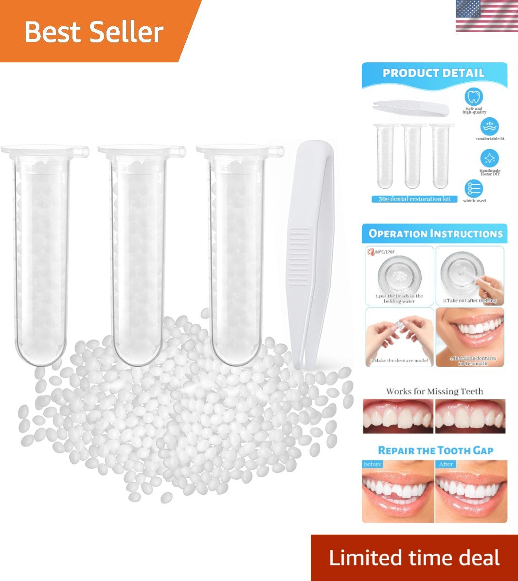 Dental Repair Kit Moldable Thermal Beads for Missing or Broken Teeth
