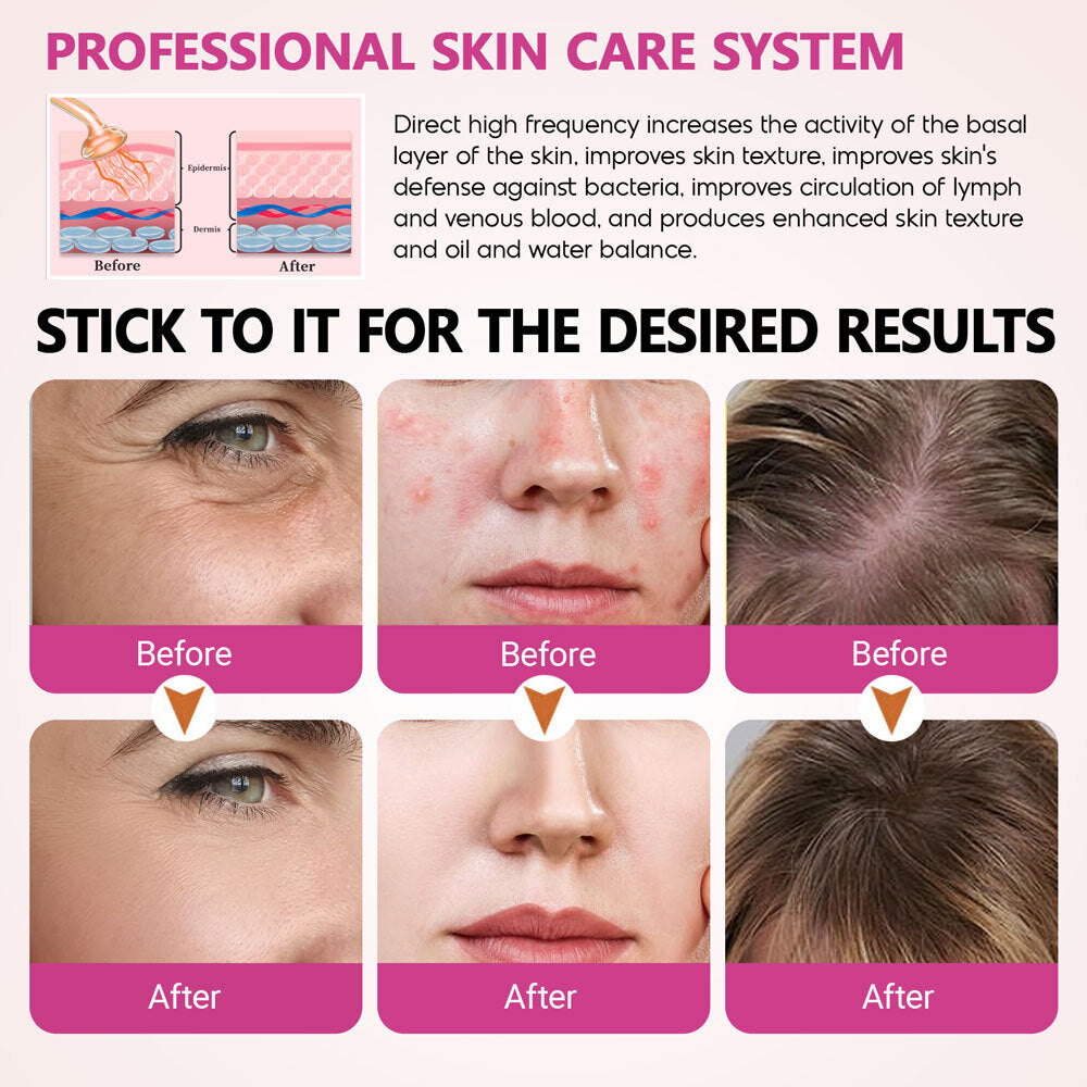 Portable High Frequency Facial Device for Skin Therapy with 4 Glass Wands