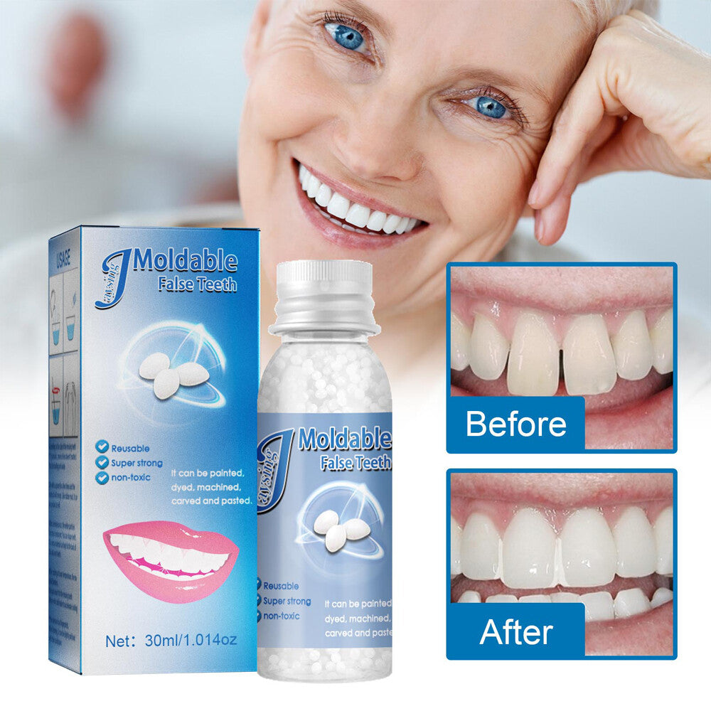 Tooth Repair Kit - Temporary Teeth Replacement Beads for Broken & Missing Teeth