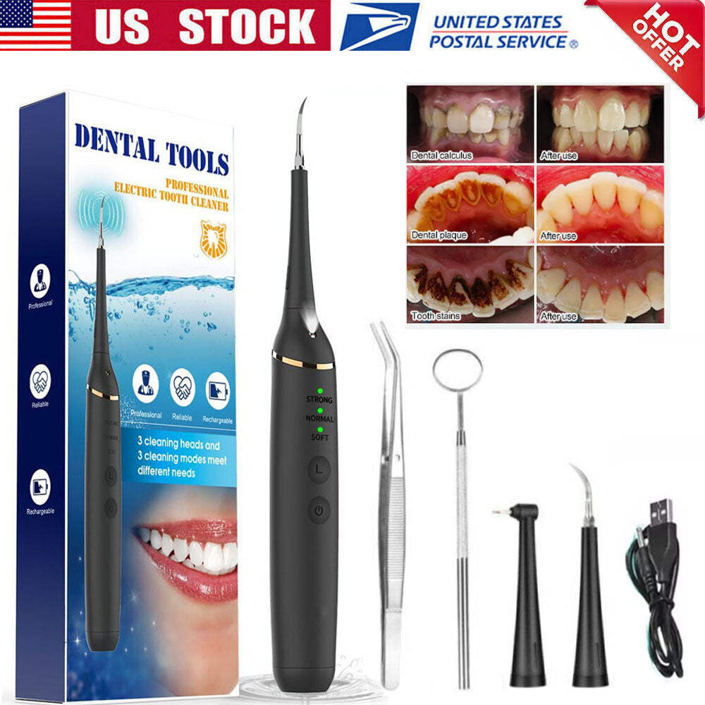 Portable Ultrasonic Tooth Cleaner Plaque & Tartar Remover - Rechargeable Dental Hygiene Device