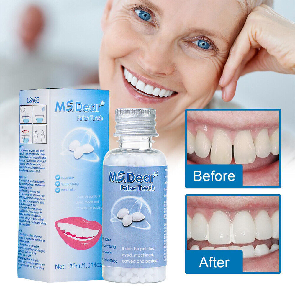 Temporary Dental Repair Kit for Broken Teeth & Cavities - Reusable Teeth Filler