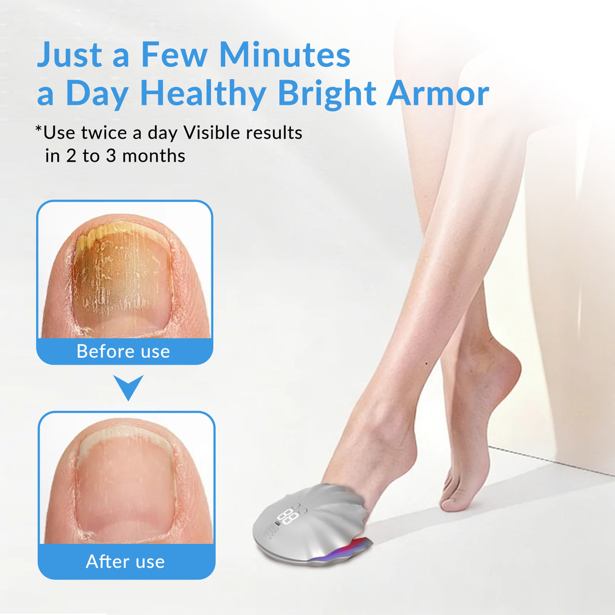 Nail Fungus Laser Treatment Device for Toenail & Fingernail Care