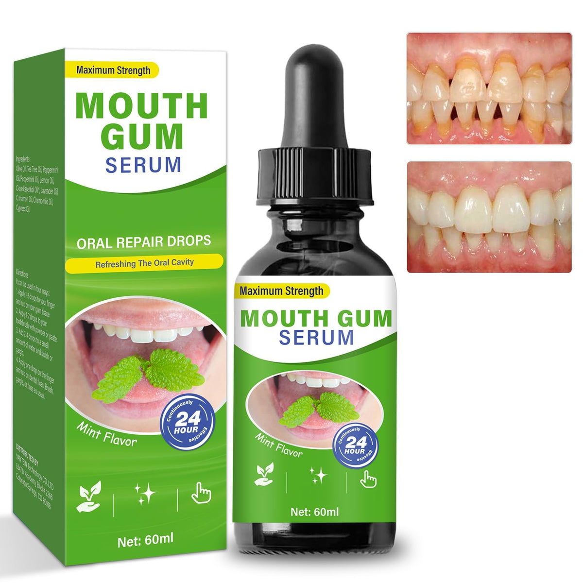 Gum Restore Drops for Receding Gums - Natural Oral Care, 1 Count