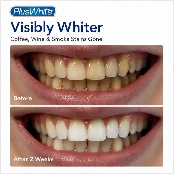 Plus White Speed Whitening Gel - 5 Minute , 2 oz