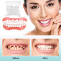 Silicone Denture Repair Kit for Upper & Lower Teeth - DIY Teeth Glue Set