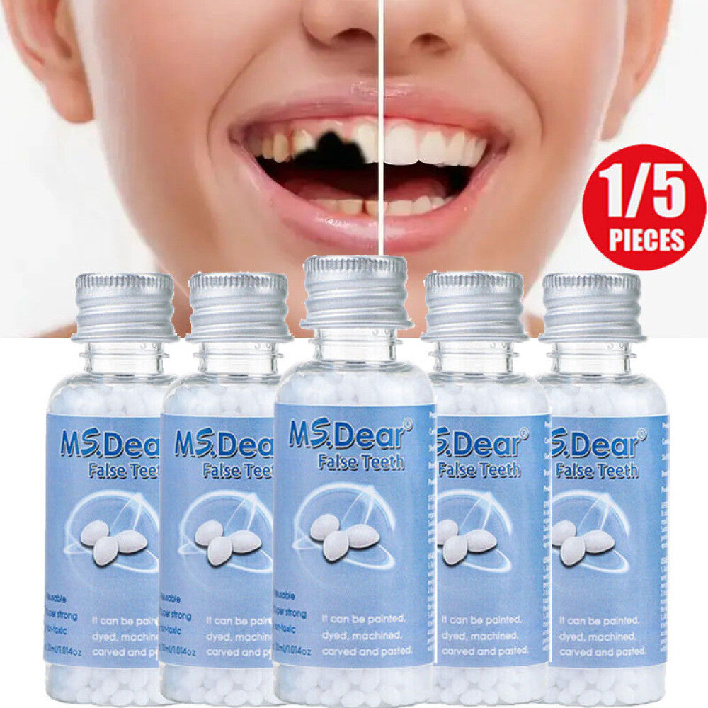 Temporary Dental Repair Kit for Broken Teeth & Cavities - Reusable Teeth Filler