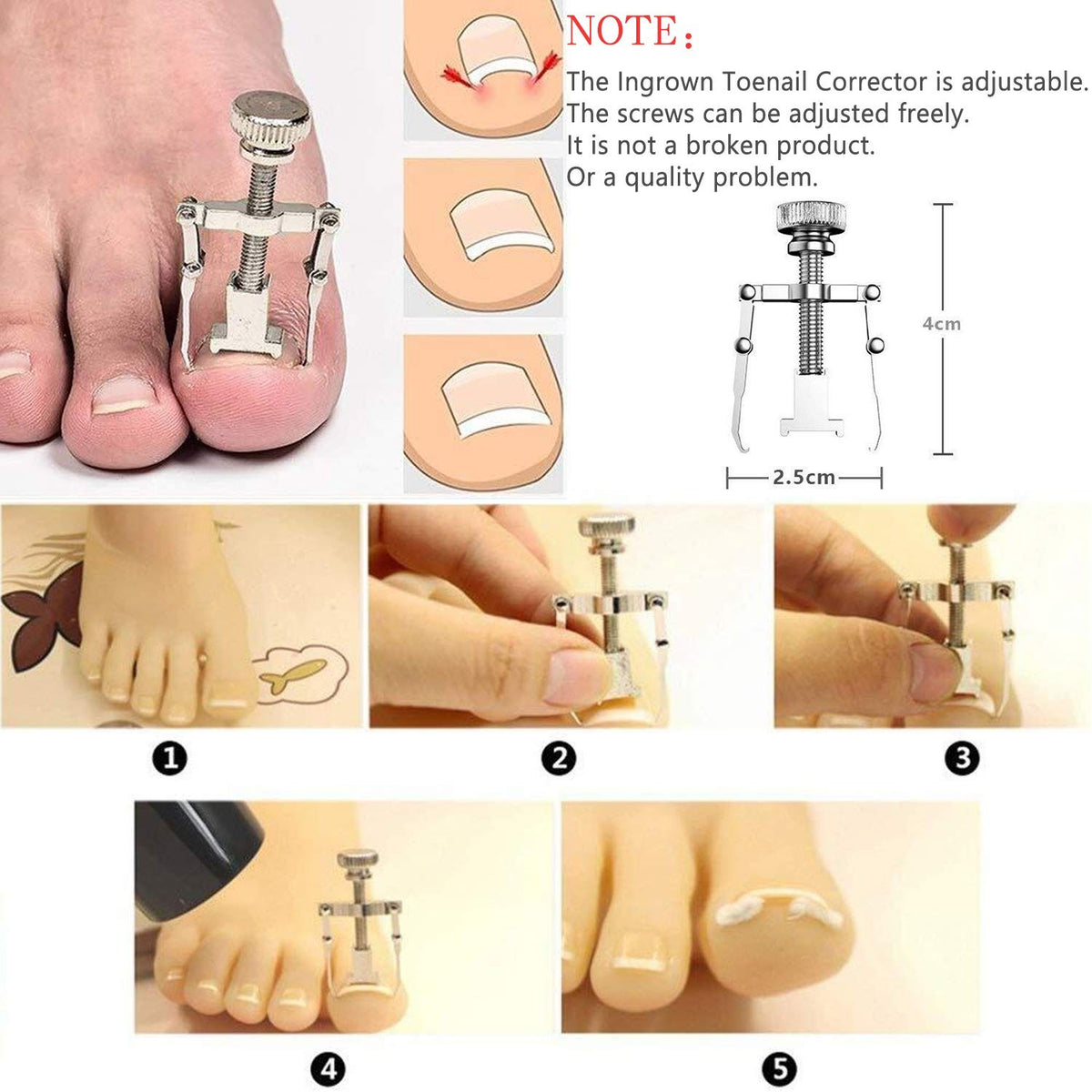 9-Pack Toenail Clippers Set - Stainless Steel Nail Care Kit for Healthy Nails
