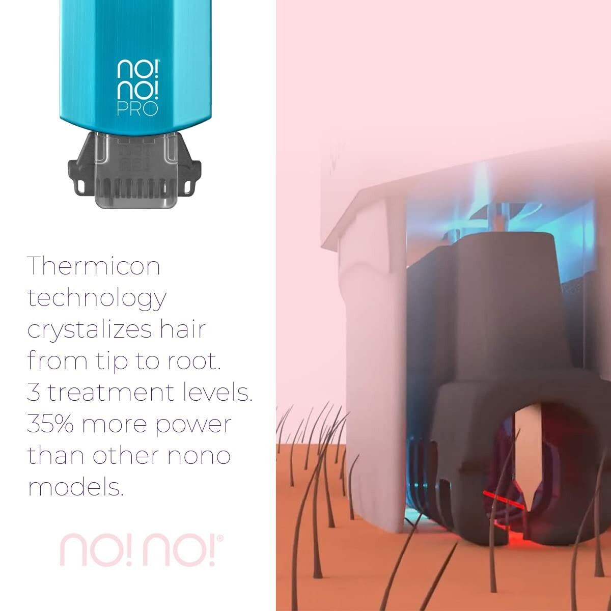 No!No! Pro Plus Rose Hair Removal System - Painless, Full Warranty