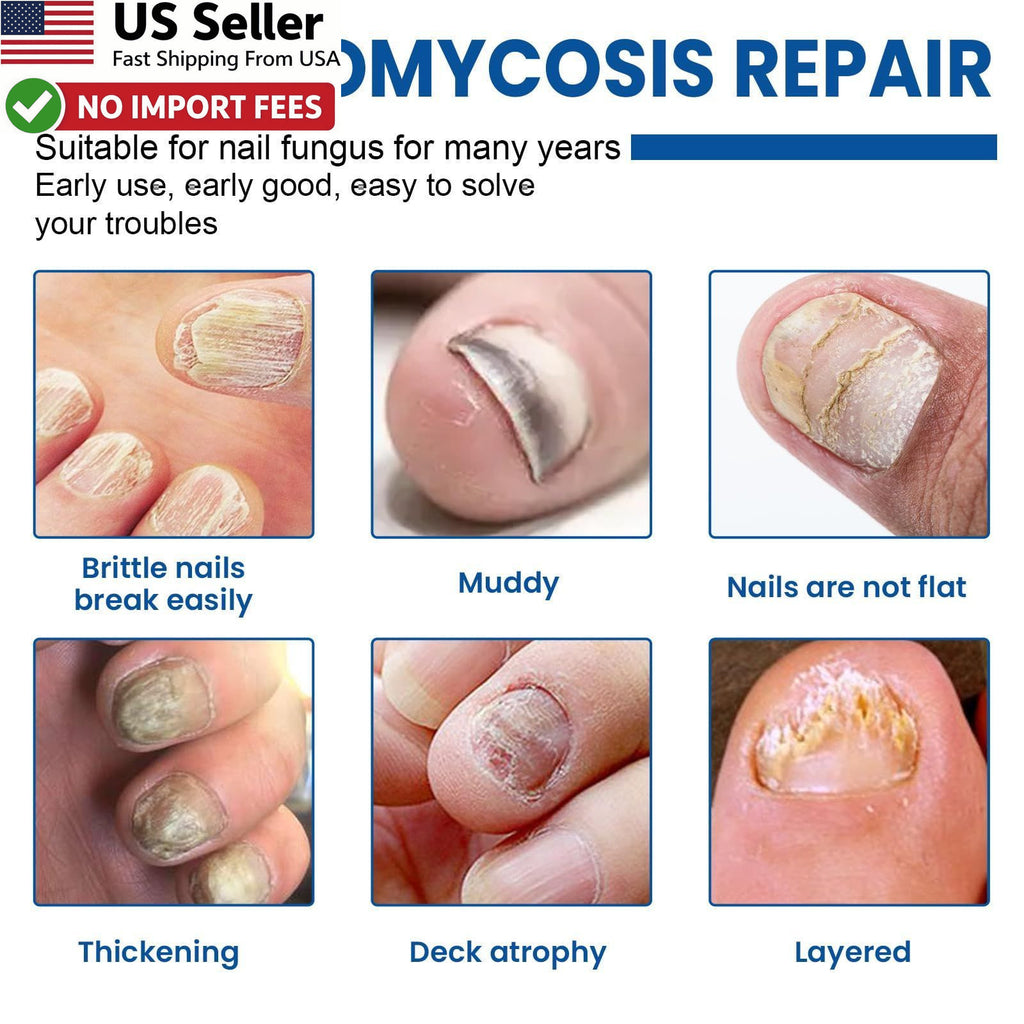 Fungal Nail Treatment Patches 60 Pack - Toenail Repair & Discoloration Relief