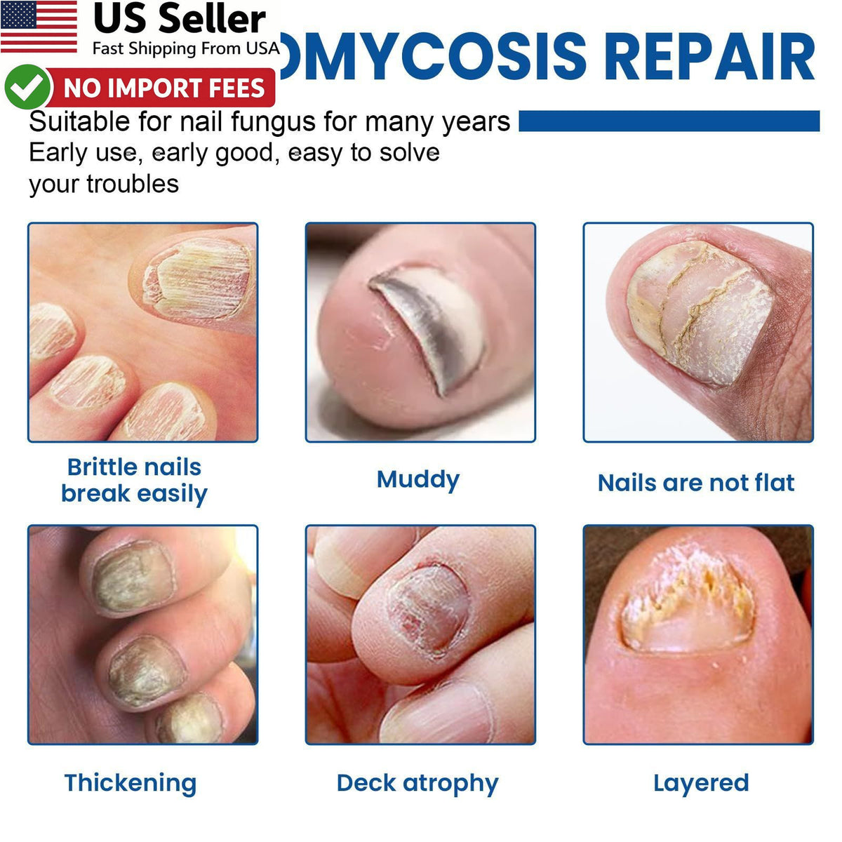 Fungal Nail Treatment Patches 60 Pack - Toenail Repair & Discoloration Relief