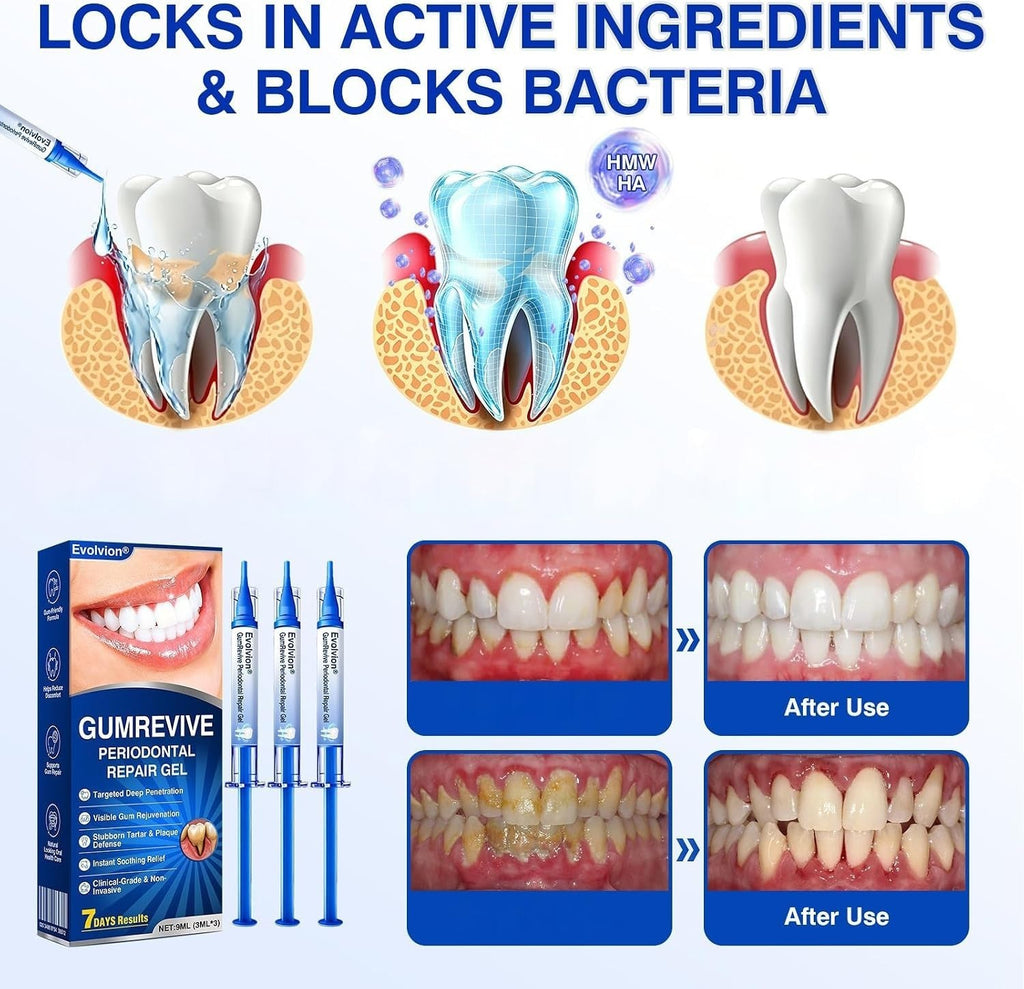 GumRevive Periodontal Repair Gel - Fresh Mint Teeth & Gum Treatment