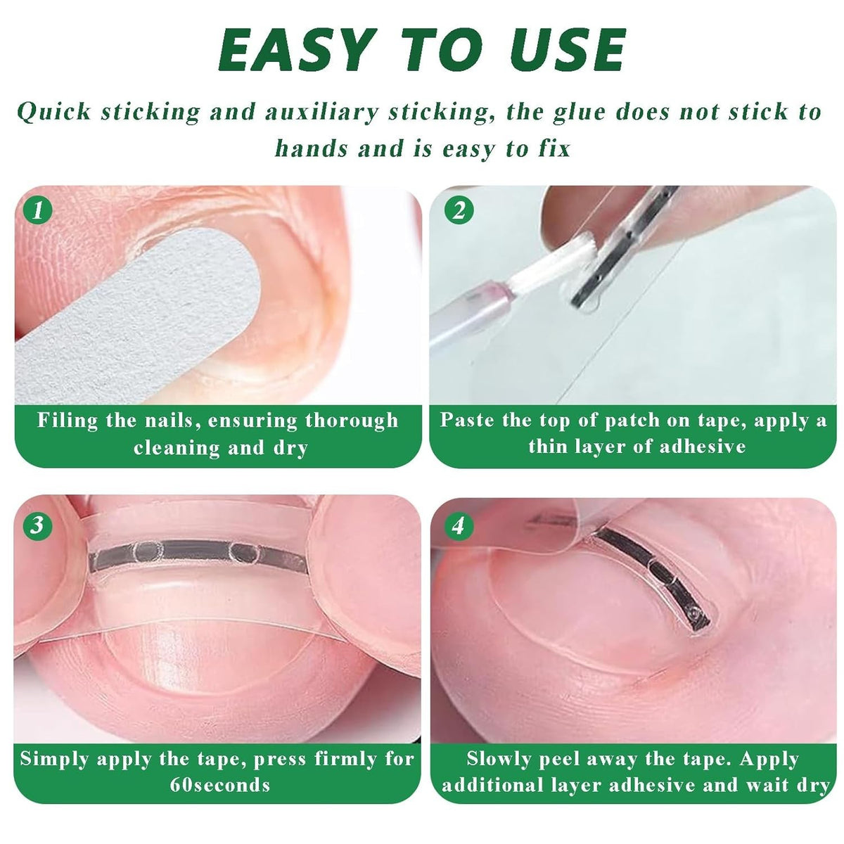 Ingrown Toenail Correction Patch Kit - Nail Fix & Deformation Treatment