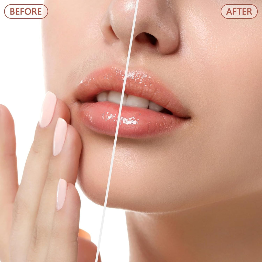 Electric Facial Hair Remover for Women Rose Gold - Pain-Free & Precise