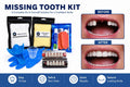 DIY Missing Tooth Replacement Kit - Custom Fit Partial Flipper for 1-6 Front Teeth