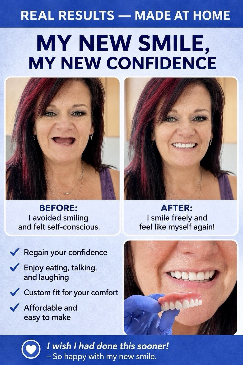 DIY Denture Kit with Alginate for Custom Fit Upper & Lower Teeth - Complete Home Impression Set