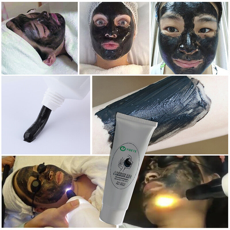 Carbon Gel for Laser Skin Rejuvenation - 3 Pack for Nd YAG Facial Treatments