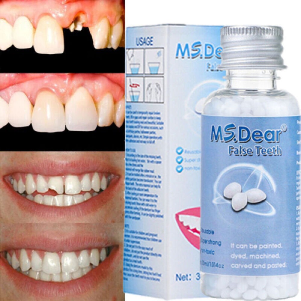 Teeth Repair Glue - Moldable Temporary Dental Cement for Broken Gaps 30ml