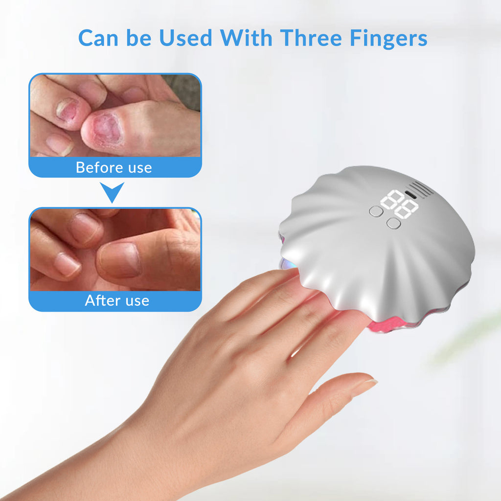 Nail Fungus Laser Treatment Device for Toenail & Fingernail Care